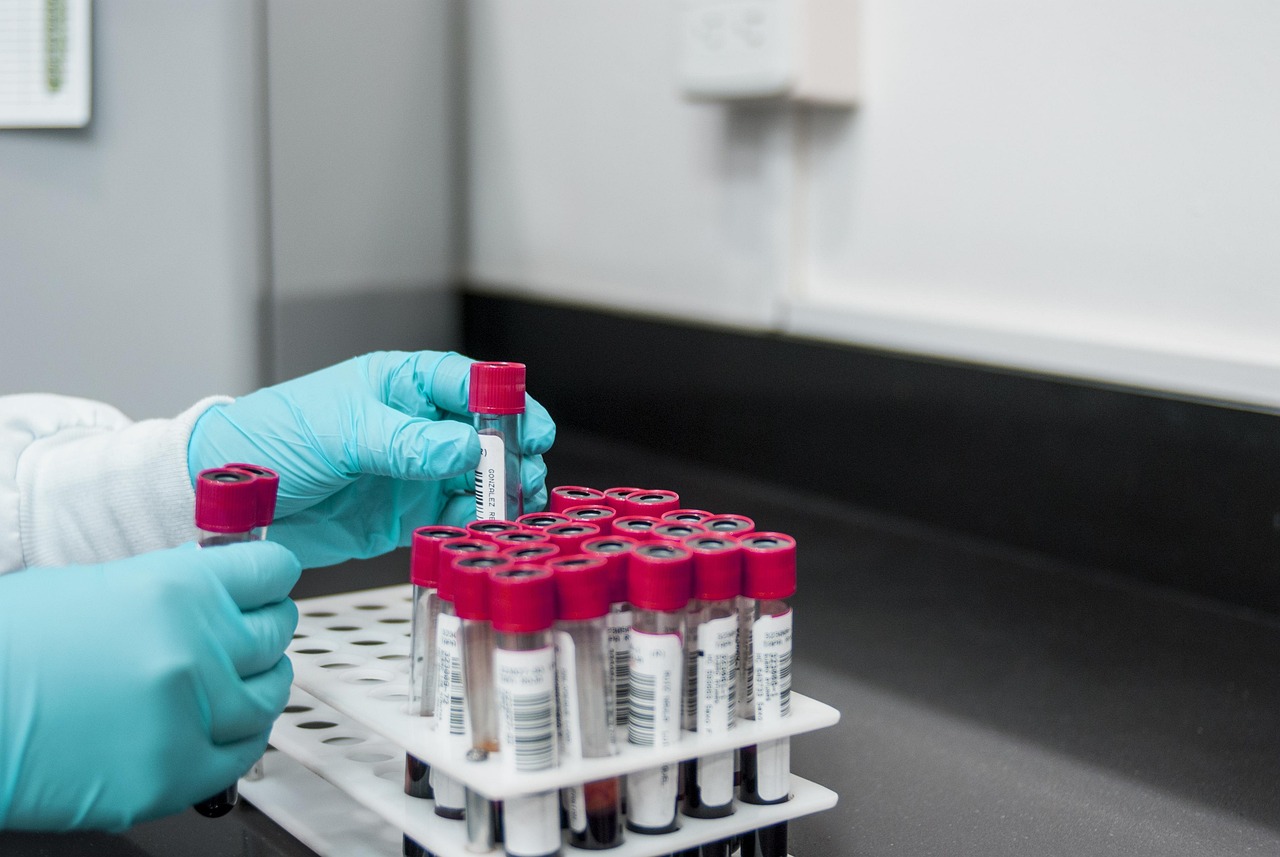 Blood Test